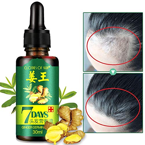 Ginger Germinal Oil,2019 Hair Growth Oil ,Hair Growth Treatment for Women Men With Thinning Hair Loss Serum for Healthier, Thicker, Longer Hair