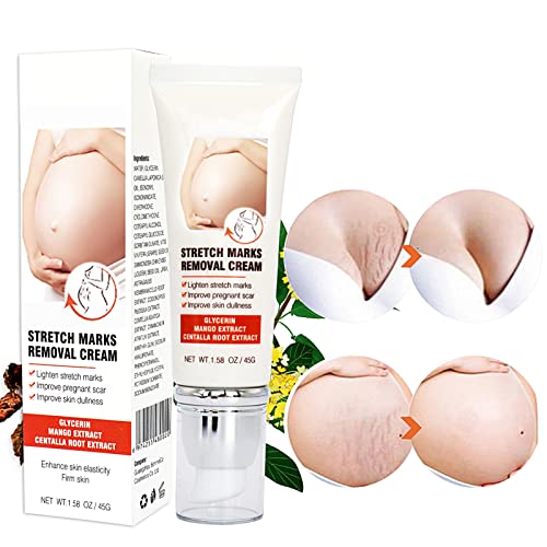 Stretch Marks Removal Cream, Stretch Marks Cream, Body Repair Cream with Centella Glycerol, Reduction of Stretch Marks for Women After Pregnancy, 45 g